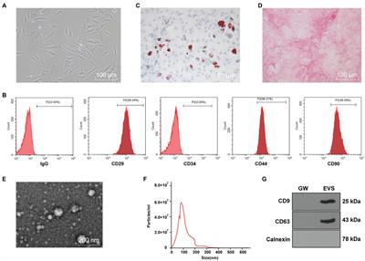 Human Bone Marrow Mesenchymal Stromal Cell-Derived Extracellular Vesicles Promote Proliferation of Degenerated Nucleus Pulposus Cells and the Synthesis of Extracellular Matrix Through the SOX4/Wnt/β-Catenin Axis